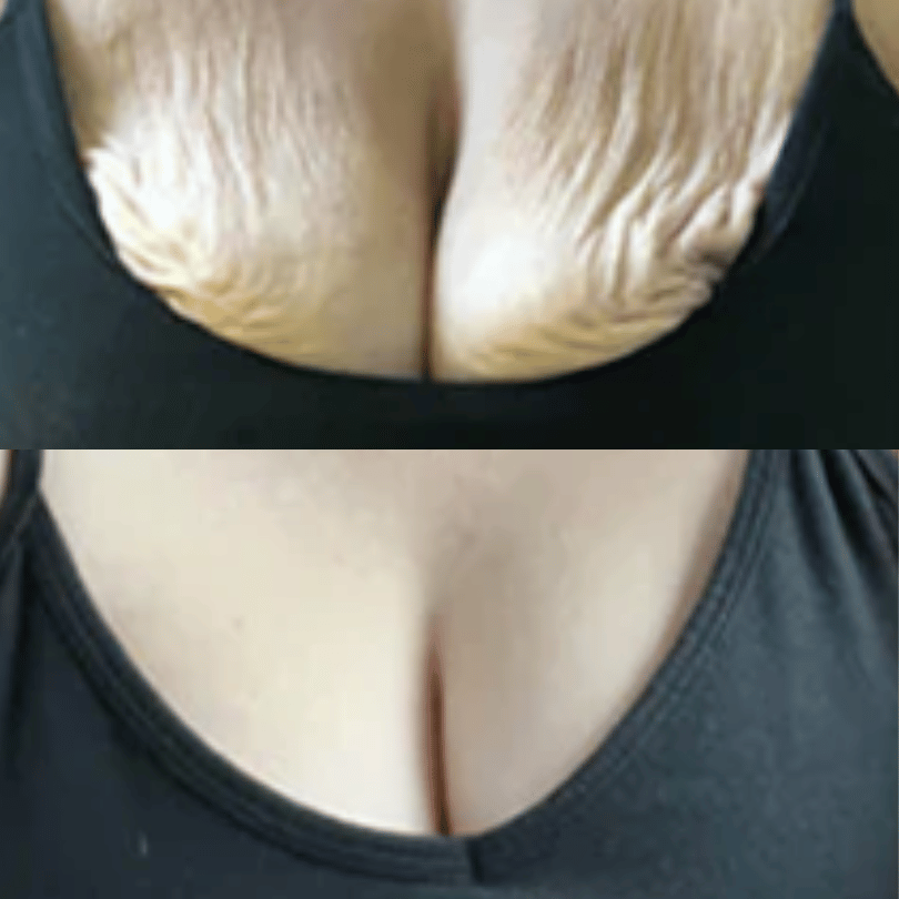 Before and after with XeiuC Collagen Oil